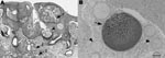 Thumbnail of A) Section of nasal mucosa showing multifocal hyperplasia, juvenile sporangia (arrows) within the mucosal epithelium (1) and the lamina propria mucosae (2), and mature sporangia (arrowhead). A multifocal mixed inflammatory infiltrate can be seen within the mucosa. Stain, hematoxylin and eosin; magnification ×4; scale bar, 250 μm. B) Semithin section of nasal mucosa with juvenile sporangia (arrowheads) and a mature sporangium (arrow) with a lymphoplasmacellular inflammatory infiltrate within the lamina propria mucosae. Stain, toluidine blue; magnification ×10; scale bar, 40 μm.