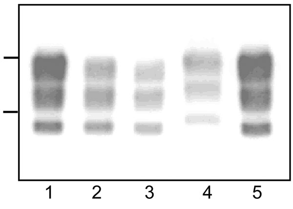 Western blot analyses of protease-resistant prion protein from proteinase K–treated brain homogenates from cattle transmissible spongiform encephalopathies (TSEs). Typical bovine spongiform encephalopathy (BSE) (lanes 1, 5), L-type BSE (lane 2), transmissible mink encephalopathy (TME) in cattle (lane 3), H-type BSE (lane 4). Bars to the left of the panel indicate the 29.0- and 20.1-kDa marker positions.