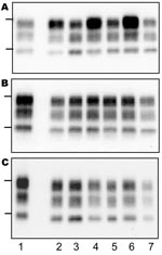 Thumbnail of Western blot of protease-resistant prion protein from TgOvPrP4 mice after proteinase K digestion and immunodetection with anti-PrP Sha31 antibody. A) First passage of typical bovine spongiform encephalopathy (BSE) (lanes 2, 4, and 6) and L-type BSE (lanes 3, 5, and 7). B) First passage of TME in cattle (lanes 2, 4, and 6) and L-type (lanes 3, 5, and 7). C) Second passage of TME in cattle (lanes 2, 4, and 6) and L-type BSE (lanes 3, 5, and 7). Each lane shows PrPres from a distinct individual mouse from each experimental group. Bars to the left of the panel indicate the 29.0- and 20.1-kDa marker positions. Lane 1, PrPres control from a scrapie-infected TgOvPrP4 mouse (C506M3 strain).