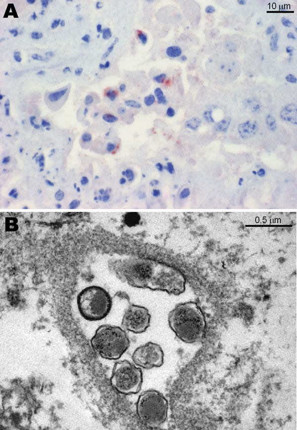 A) Immunohistochemical analysis of a bovine placenta positive by PCR for Parachlamydia acanthamoebae, showing a positive brown-red granular reaction within trophoblastic epithelium. Antigen detection was conducted with a polyclonal antibody against Parachlamydia spp. (3-amino-9-ethylcarbazole/peroxidase method, hematoxylin counterstain). B) Transmission electron micrograph of bovine placenta positive by PCR and immunohistochemical analysis for P. acanthamoebae, showing 7 cocci-shaped bacteria in an inclusion with morphologic features similar to those of Chlamydia-like organisms (12).