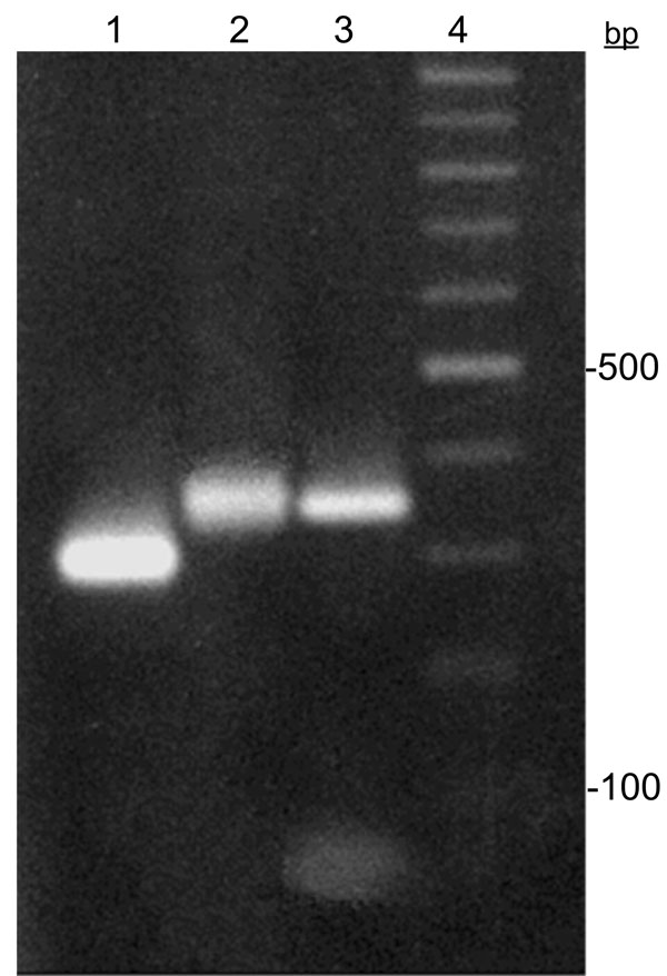 Trypanosoma cruzi miniexon gene typing assay. Lanes 1 and 2, T. cruzi II (300 bp) and T. cruzi I (350 bp) markers, respectively; lane 3, T. cruzi I cloned fragment recovered from Brazilian mummy; lane 4, 100-bp ladder.