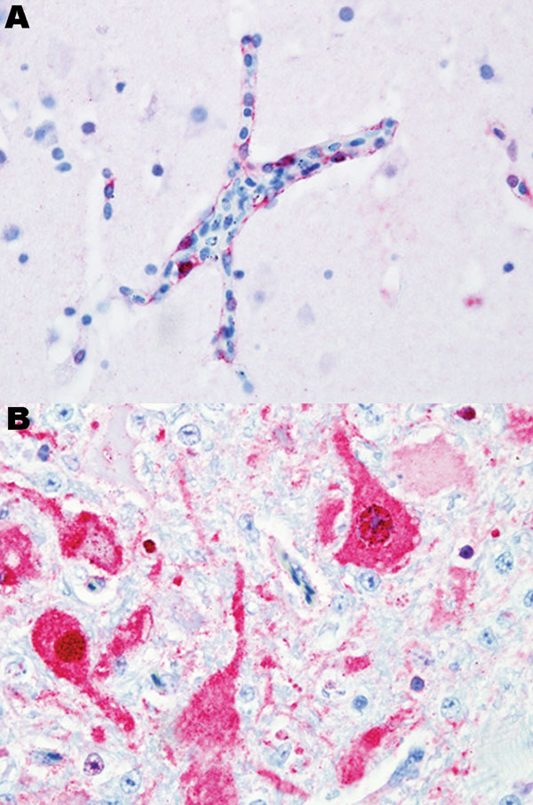 Figure 1&nbsp;-&nbsp;Photomicrograph of viral antigen (red). A) Endothelial cells lining a blood vessel in the brain of a black swan. B) Neurons in the brain of a mute swan. Both birds died after experimental infection with highly pathogenic avian influenza virus (H5N1). Immunohistochemical stain with hematoxylin counterstain. Magnification ×40.