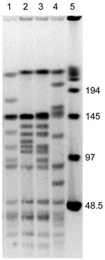 Thumbnail of SmaI macrorestriction patterns of Bartonella henselae isolates from 2 cats. Lane 1, cat 36, first isolate; lane 2, cat 36, second isolate obtained 12 months later; lane 3, cat 75, first isolate; lane 4, cat 75, second isolate obtained 12 months later; lane 5, bacteriophage λ molecular mass pulsed-field gel electrophoresis marker. Values on the right are in kilobases.