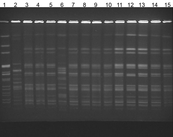 Pulsed-field gel electrophoresis of isolates from patients with Alcaligenes xylosoxidans bloodstream infection. Lane 1, laboratory standard; lanes 2 and 6, community strains of A. xylosoxidans; lanes 3–5 and 7–13, outbreak strains; lane 14, central venous catheter (CVC) port biofilm outbreak strain; lane 15, CVC port outbreak stain.