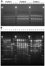 Thumbnail of Internal transcribed spacer–restriction fragment length polymorphism (ITS-RFLP) patterns obtained by double digestion with the enzymes Sau96I and HhaI (A) and of the PCR fingerprinting profiles obtained with the microsatellite specific primer M13 (B) for Scedosporium prolificans: lane 1, WM 06.457; lane 2, WM 06.458; lane 3, WM 06.503; lane 4, WM 06.502; lane 5, WM 06.399; lane 6, WM 06.434. S. aurantiacum: lane 7, WM 06.495; lane 8, WM 06.496; lane 9, WM 06.386; lane 10, WM 06.385;