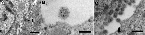 Pathology of a duck infected with A/chicken/Yamaguchi/7/2004. A) Electron microscopy of the feather epidermis showing virions observed between epidermal cells with the desmosome (d) and nucleus (n). Bar = 500 nm. B) Spherical virion with envelope spikes. Bar = 100 nm. C) Budding process of virion (arrowhead). Bar = 250 nm.