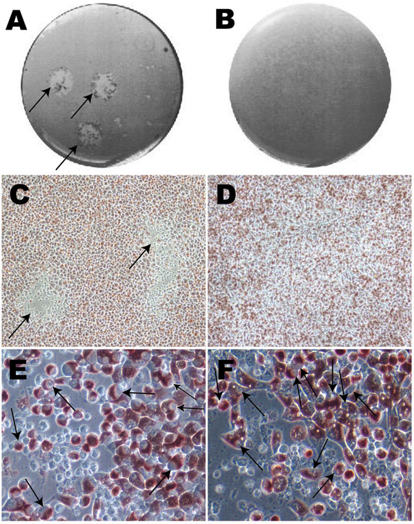 Photographs and optical microscopy views of the wells showing plaques formed by Chlamydia trachomatis F/IC-Cal3 (A, C, E) and no plaque formed by clinical F persistent strain (B, D, F). A) Single well showing 2 distinct plaques (indicated by arrows). B) Well showing no plaque morphology. C) and D) Optical microscopy image showing plaque areas with little or no neutral red staining (arrows) surrounded by viable cells stained red (magnification ×100). Higher magnification (×400) showed numerous cells that had been infected by reference strain F/IC-Cal3 (E) and the clinical persistent F strain (F).