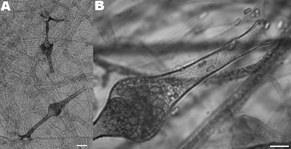 Microscopic characteristics of the isolate of Saksenaea vasiformis cultured on Czapek agar. A) Typical flask-shaped sporangia (scale bar = 25 μm) containing B) smooth-walled, rectangular sporangiospores (scale bar = 10 μm).