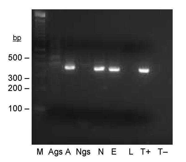 Seminested PCR detection of Bartonella spp. DNA in Ixodes ricinus ticks fed on B. henselae–infected ovine blood at preceding stage. Lane M, 100-bp DNA molecular mass marker; lane Ags, salivary glands of a female adult fed on infected blood as a nymph; lane A, carcass of a female adult fed on infected blood as a nymph; lane Ngs, salivary glands of a nymph fed on infected blood as a larva; lane N, carcass of a nymph fed on infected blood as a larva; lane E, eggs laid by female adult fed on infected blood; lane L, larvae hatched from female adult fed on infected blood; lane T+, B. bacilliformis DNA; lane T–, nymph fed on uninfected ovine blood.