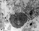 Thumbnail of Rickettsia conorii conorii localized in cytoplasm of host cells as seen by electron microscopy (magnification ×100,000).