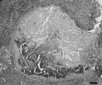 Thumbnail of Granulomatous lymphadenitis caused by Mycobacterium bovis in a coyote (Canis latrans). The granulomas consist of a large central necrotic area with mineralization and cholesterol clefts surrounded by a thin rim of primarily macrophages and fibrous connective tissue. Scale bar = 55 μm.