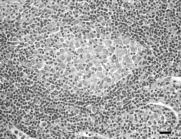 Focal histiocytic lymphadenitis caused by Mycobacterium bovis in a coyote (Canis latrans). Note the small, poorly delineated, aggregates of primarily macrophages within the lymph node cortex. Scale bar = 25 μm.