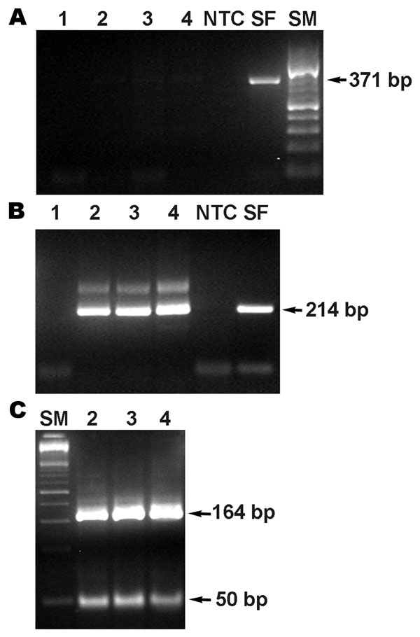 PCR product from the 17-kDa protein antigen gene obtained from DNA extracted from necropsied tissues of the patient. Primary PCR (A), nested PCR (B), and BfaI restriction enzyme pattern of the 17-kDa protein gene amplicon (C). Lane 1, reagent control; 2, skin; 3, liver; 4, lung; NTC, nontemplate control; SF, Rickettsia conorii DNA control; SM, size markers.
