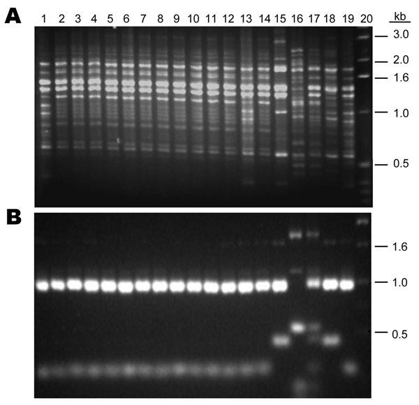 DNA fingerprint patterns of 12 Cryptococcus neoformans strains from China and the molecular type reference strains. A) M13-based PCR pattern. B) URA5 restriction fragment length polymorphism. Lanes: 1, VNI; 2–12, 11 Chinese strains; 13, H99; 14, Chinese strain B-4587; 15, VNBt63; 16, VNI; 17, VNIII; 18, VNII; 19, VNI; 20, marker.