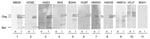 Thumbnail of Figure 1&nbsp;-&nbsp;Western blot assays using human serum. Dilutions of human serum (lanes 2–11) or a foamy virus–-positive Macaca mulatta MBG8 (lane 1) were used to probe filter strips containing equal amounts of lysates from simian foamy virus–infected cells (from M. fascicularis; i lanes) or noninfected cells (u lanes). Individual strips were developed by using TMB reagent (3,3′,5,5′-tetramethylbenzidine; Promega, Madison, WI, USA). The positions of the viral proteins Gag and Be