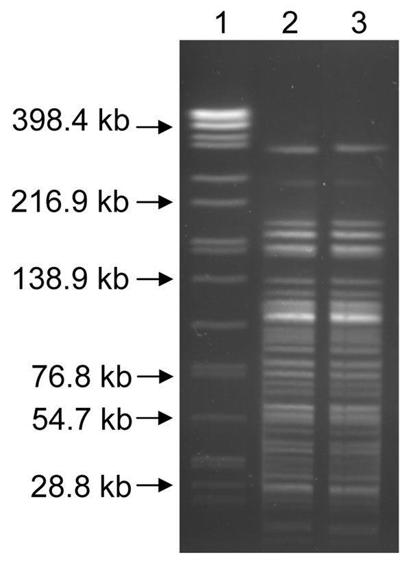 AscI pulsed-field gel electrophoresis patterns for the Yersinia pestis isolates recovered from soil (lane 3) and the mountain lion (lane 2). Lane 1, Salmonella enterica serotype Braenderup standard.