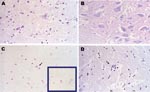 Thumbnail of Figure 2&nbsp;-&nbsp;Pathologic images obtained from a carcass of Eptesicus isabellinus. The bat was captured while flying but died during handling. Brain specimen was positive for lyssavirus antigens by immunofluorescence and for European bat lyssavirus 1 RNA by reverse transcription–PCR. A) Neural degeneration in brain by hematoxylin and eosin stain (H&amp;E); magnification ×400. B) Negative Seller stain in spinal cord indicating the absence of Negri bodies; magnification ×400. C)