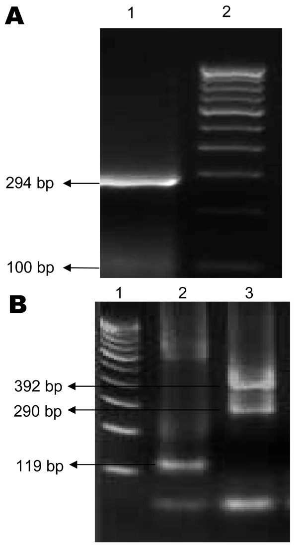 Agarose gel electrophoresis showing chikungunya virus (A) and dengue virus (B) PCR products. A) Lane 1, 294-bp product specific for chikungunya virus; lane 2, 100-bp DNA marker. B) Lane 1, 100-bp DNA marker; lane 2, 119-bp product specific for dengue 2 virus; lane 3, 290-bp product for dengue 3 virus and 392-bp product for dengue 4 virus.