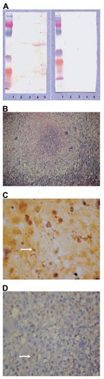 Thumbnail of A) Western blotting analysis of lymph node specimen from the patient before 1) and after 2) cross-adsorption with Bartonella alsatica. Lane 1, B. quintana; lane 2, B. henselae; lane 3, B. elizabethae; lane 4, B. vinsonii subsp. berkhoffii; lane 5, B. alsatica. B) Characteristic histologic change in the lymph node with B. alsatica infection. Shown is an inflammatory granulomatous process with central microabscess surrounded by a ring of macrophages and rare giant cells (hematoxylin and eosin stain, original magnification x100). C) Bacteria (arrow) in an abscess formation mixed with necrotic debris (Warthin-Starry silver stain, original magnification x1,000). D) Immunohistochemical detection of B. alsatica (arrow) in lymph node pulp with an extracellular distribution (polyclonal antibody and hematoxylin counterstain, original magnification x400).