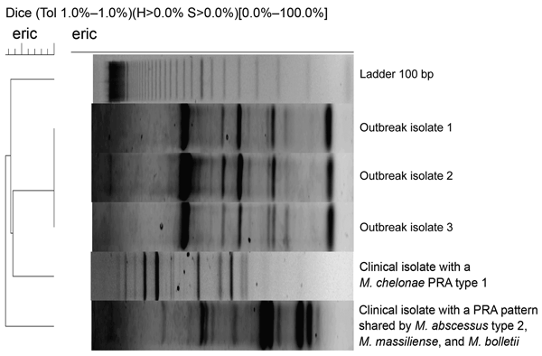 DNA enterobacterial repetitive intergenic consensus PCR (eric) analysis of rapidly growing mycobacteria isolated from 3 patients in a mesotherapy-associated outbreak, January–February, 2007, Buenos Aires city, Argentina, compared with profiles of epidemiologically unrelated clinical isolates of the Mycobacterium abscessus–M. chelonae group. The dendrogram was constructed with the aid of BioNumerics software v 4.6 (Applied Maths, Sint-Martens-Latem, Belgium), using Dice unweighted pair group meth