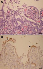 Thumbnail of A) Marked shortening and blunting of the intestinal villi (scale bar = 25 µm). B) Intestinal epithelial cells expressing porcine epidemic diarrhea virus antigen (arrowheads) in the cytoplasm (colon), visible as brown staining (scale bar = 25 µm).