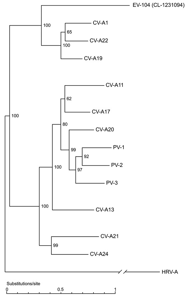 Full genome phylogenetic tree of enterovirus 104 (EV-104), representative strain CL-1231094, and members of the human enterovirus C (HEV-C) species. Human rhinovirus A (HRV-A) (GenBank accession no. DQ473509) was used as outgroup. Coxsackievirus A1 (CV-A1) (AF499635), CV-A21 (AF546702), CV-A20 (AF499642), CV-A17 (AF499639), CV-A13 (AF499637), CV-A11 (AF499636), CV-A19 (AF499641), CV-A22 (AF499643), CV-A24 (D90457), poliovirus 1 (PV-1) (V01148), PV-2 (X00595), and PV-3 (X00925) sequences were obt