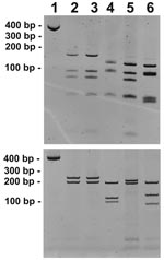 Thumbnail of Restriction fragment length polymorphism patterns of gltA (A) and 17-kDa gene (B) PCR products digested with AluI. Lane 1, undigested gltA and 17-kDa gene PCR amplicons (from blood sample of infected child); lane 2, human case; lane 3, Rickettsia typhi–positive control; lane 4, R. felis–positive control; lane 5, R. akari–positive control; lane 6, R. rickettsii–positive control.