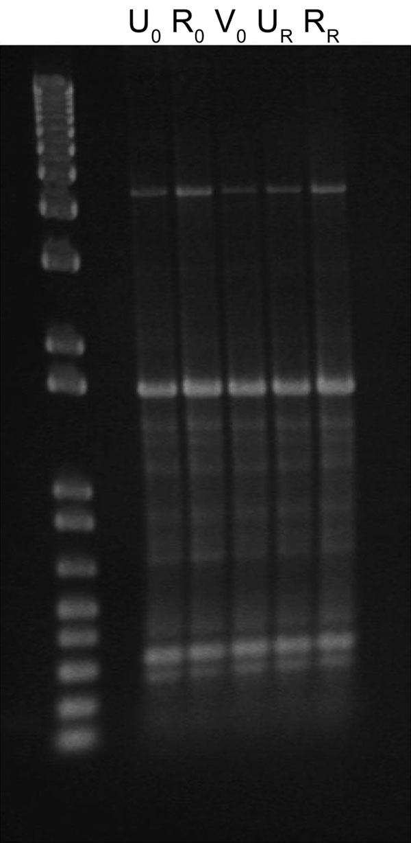 Enterobacterial repetitive intergenic consensus typing of extended-spectrum β-lactamase–producing Escherichia coli isolated from index (0) and recurring (R) urine (U), rectal (R), and vaginal (V) samples from a nonpregnant young woman.