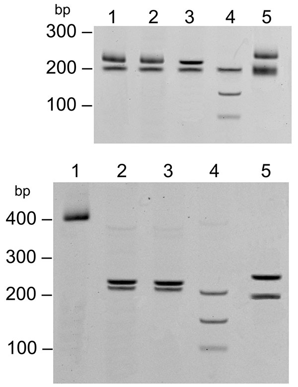 Restriction fragment length polymorphism of the 17-kDa PCR product (434 bp) digested with AluI. Top: lane 1, 32-year-old woman; lane 2, 9-year-old girl; lane 3, Rickettsia akari–positive control; lane 4, R. rickettsii–positive control; lane 5, R. typhi–positive control. Bottom: lane 1, undigested 17-kDa gene PCR amplicon; lane 2, 9-year-old girl; lane 3, 32-year-old woman; lane 4, R. conorii–positive control; lane 5, R. honei–positive control.