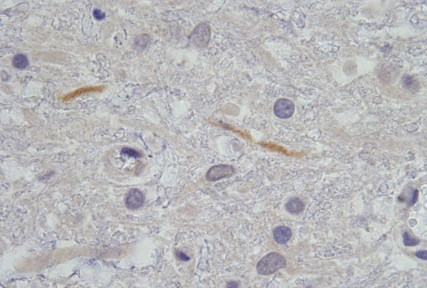 Histopathologic section of 2 lumbar spine gray matter dendrites that stained immunohistochemically positive with flavivirus antiserum on postmortem tissue of horse HS101/08. Magnification ×1,000.