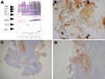 Thumbnail of A) Western blot of serum sample from patient infected with Candidatus Bartonella mayotimonensis. Left lane, Molecular mass standard; lane 1, Bartonella quintana; lane 2, B. henselae; lane 3, B. elizabethae; lane 4, B. vinsonii subsp. berkhoffii; lane 5, B. alsatica. Values on the left are in kilobases. B) Numerous darkly stained bacilli consistent with Bartonella species organized in clusters in the valvular vegetation (Warthin-Starry stain; original magnification ×400). C and D) Ba