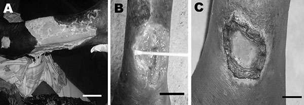Patient 1: extensive ulcer of the right limb (A). Patient 2: ulcer of the left ankle before treatment (B) and 8 weeks after specific antimicrobial drug therapy (C). Scale bars = 12 cm (A), 5 cm (B), and 2 cm (C).