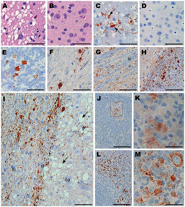 Immunohistochemical analysis of squirrel monkeys infected with chronic wasting disease (CWD) agent. Panels A, C, and E–M are from squirrel monkeys infected with CWD. Panels B and D are from an uninfected monkey showing no pathologic changes or positive staining for protease-resistant prion protein (PrPres). Panels A and B, cerebral cortex stained with hematoxylin and eosin; panels C and D, thalamus stained with antibody 3F4 against PrP (arrows); panels E and F, cerebellar granular cell layer and