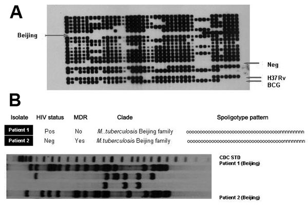 A) Identification of isolates of the Mycobacterium tuberculosis Beijing clade (6) by using spoligotyping. The spoligotype pattern of the M. tuberculosis Beijing clade is characterized by the absence of hybridization of spacers 1–34 as shown, in combination with hybridization of spacers 35–43. Negative control (Neg.) shows absence of all spacers. For comparison, H37Rv (a laboratory strain) and M. bovis BCG show different patterns of spacers. Also shown are other clades not identified. B) Restric