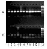 Thumbnail of Parallel PCR amplification of PARV4-like (A) and PPV (B) by using purified DNA from clotting FVIII preparations. The results of this PCR usually suggested a higher PARV4 load despite the higher efficiency of the PPV PCR (J. Szelei and P. Tijssen, unpub. data). This finding was confirmed with the quantitative MIMIC PCR method for PPV (11). Numbers indicate different lots of FVIII prepared in 1:1994A, 2:1994B, 3:1996A, 4:1996B, 5:1999, 6:2000A, 7:2000B, 8:2001A, 9:2001B, 10:2001C, 11: