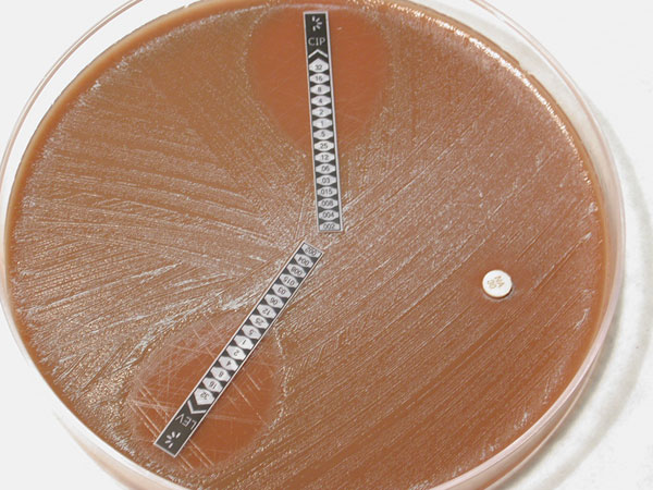 Antimicrobial drug–susceptibility test, showing resistance to levofloxacin (LEV, lower strip), ciprofloxacin (CIP, upper strip), and nalidixic acid (NA, disk) for the strain of Neisseria meningitidis isolated from the patient.