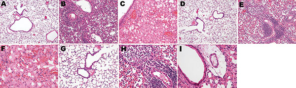 Photomicrographs of the lung sections of influenza A virus (H1N1)– and (H5N1)–infected mice at endpoint (hematoxylin and eosin stain). Dramatically different histopathologic signatures are observed, with either a mostly cellular reaction (H1N1) or a mostly humoral reaction (H5N1). Panels A, D, and G: 3 views of vehicle-infected lungs (original magnification ×100). Panels B and E, subtype H1N1: Dense granulocytic and lymphocytic cell infiltrates in the interstitium and around vessels and airways