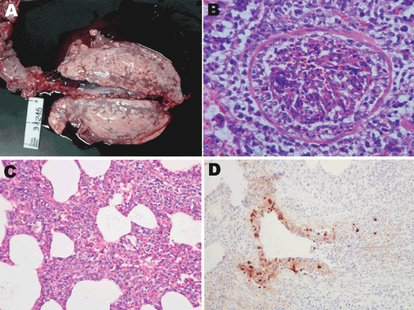 Postmortem samples from clinically affected pigs, Argentina, 2009. A) Macroscopic lung lesions with distinctive scattered dark-red foci of lobular consolidation (chessboard-like) in all lobes. B) Severe necrotizing bronchiolitis with partially denuded epithelia. Hematoxylin-eosin stain; original magnification ×400. C) General view of the alveolar walls showing moderate interstitial thickening by leukocytes. Hematoxin-eosin stain; original magnification ×200. D) Bronchioli. Positive-labeled nucle