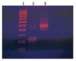 Thumbnail of HaeIII digestion of adenovirus 36 (Adv 36) DNA PCR products of the patient. Lane 1, molecular size marker; lane 2, HaeIII digest of Adv 36 DNA; lane 3, undigested Adv 36 DNA.