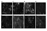 Thumbnail of Immunofluorescent detection (polyclonal antibody, original magnification ×100) of Yersinia pestis in the feces of body lice during cycles 1 and 2. A) Biotype Antiqua–infected lice feces during cycle 1. B) Biotype Antiqua–infected lice feces during cycle 2. C) Biotype Medievalis–infected lice feces during cycle 1. D) Biotype Medievalis–infected lice feces during cycle 2. E) Biotype Orientalis–infected lice feces during cycle 1. F) Biotype Orientalis–infected lice feces during cycle 2