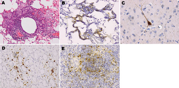 Pathologic signs associated with Nipah virus infection in squirrel monkeys. A) Focal inflammation in the lung (monkey B). Hematoxylin and eosin stains; original magnification ×10. B) Viral antigens (brown staining) were immunolocalized to the alveolar walls (monkey E). C) brain neuron (monkey B). D) Tubular and extratubular cells in the kidney (monkey E). E) Lymphoid cells in the spleen (monkey D). B–E, immunoperoxidase stains, original magnification ×20.