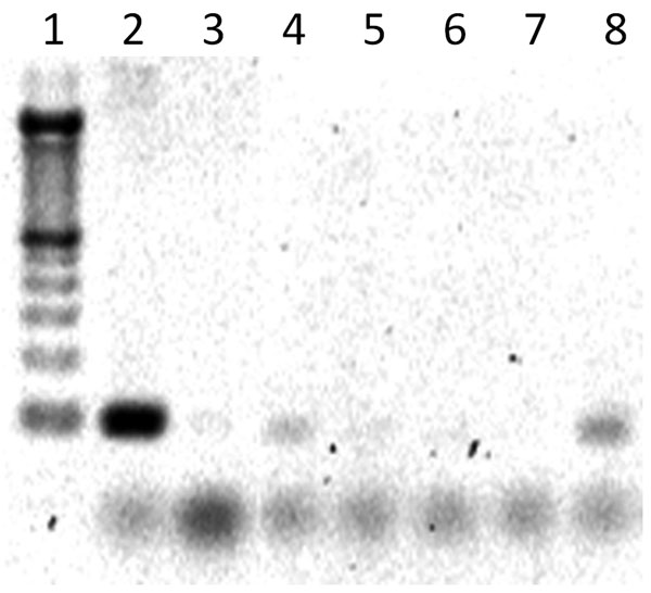 PCR gel showing positive Rift Valley fever virus bands (90 bp). Lane 1, molecular mass ladder; lane 2, Rift Valley fever virus MP-12 positive control; lane 3, negative control; lane 4, pool 103 (positive); lane 5, pool 86 (negative); lane 6, pool 104 (negative); lane 7, pool 87 (negative); lane 8, pool 105 (positive).