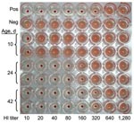 Thumbnail of Antibody titer against influenza A pandemic (H1N1) 2009 by hemagglutination inhibition (HI) test on days 10, 24, and 42 of life of the patient.