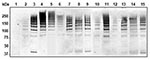 Thumbnail of Detection of high molecular weight PitB polymers in invasive isolates of Streptococcus pneumoniae. Western blot of cell wall extract from strains R6 (lane 1), GA47901 (lane 2), GA13444 (lane 3), GA47077 (lane 4), GA47340 (lane 5), GA47784 (lane 6), GA47368 (lane 7). GA47751 (lane 8), GA47187 (lane 9), GA11293 (lane 10), GA47628 (lane 11), GA49138 (lane 12), GA47434 (lane 13), GA47373 (lane 14), and GA47105 (lane 15) detected with anti-PitB antiserum. Marker sizes are indicated.
