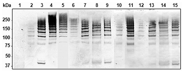 Detection of high molecular weight PitB polymers in invasive isolates of Streptococcus pneumoniae. Western blot of cell wall extract from strains R6 (lane 1), GA47901 (lane 2), GA13444 (lane 3), GA47077 (lane 4), GA47340 (lane 5), GA47784 (lane 6), GA47368 (lane 7). GA47751 (lane 8), GA47187 (lane 9), GA11293 (lane 10), GA47628 (lane 11), GA49138 (lane 12), GA47434 (lane 13), GA47373 (lane 14), and GA47105 (lane 15) detected with anti-PitB antiserum. Marker sizes are indicated.