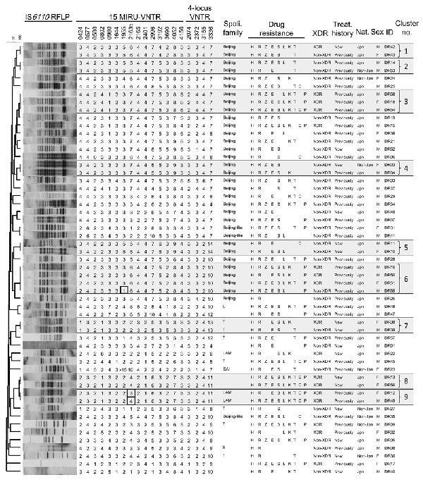 Insertion sequence 6110 restriction fragment length polymorphism (IS6110-RFLP) patterns, copy number profiles of the 19-locus variable number tandem repeat (VNTR) profiles, spoligotype family, drug-resistance profiles, comparison of extensively drug-resistant (XDR) tuberculosis (TB) and multidrug-resistant but not XDR TB (non-XDR) cases, treatment (treat.) history, nationality (nat.), and sex. The dendrogram of the 55 MDR/XDR Mycobacterium tuberculosis strains was created on the basis of their I