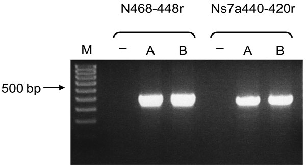 Bat coronavirus/Philippines/Dilliman1525G2/2008 mRNA in experimentally infected fruit bats, the Philippines. Reverse transcription–PCR results for small intestines of bats A and B. Lane M, 100-bp DNA ladder; lane –, nontemplate control.