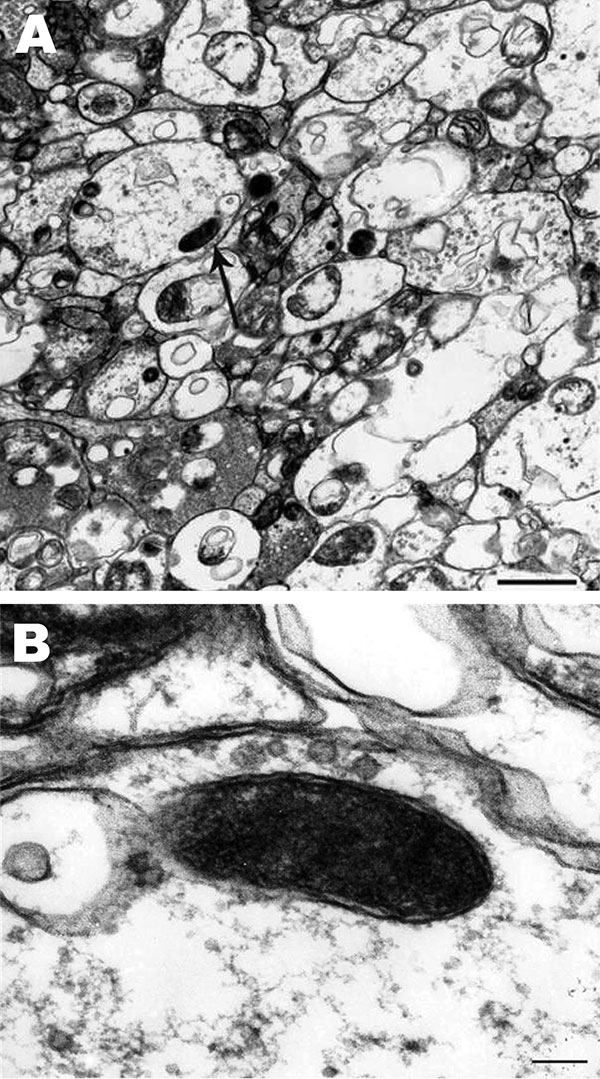 Rickettsia rickettsii (arrow) in a midgut cell of an Amblyomma imitator tick (A). The trilaminar cell wall is separated from the cell membrane by the periplasmic space (B). Scale bars = 0.1 µm.