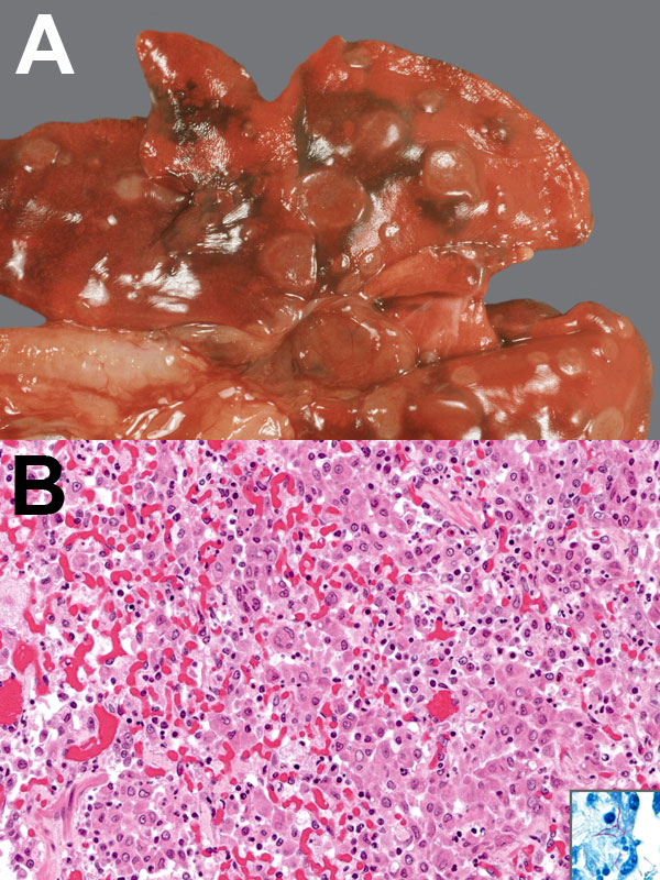 Appearance of tissue from 3-year-old, neutered male, domestic ferret with Mycobacterium celatum infection. A) Gross appearance: multiple, round light brown foci over lungs. B) Histologic appearance, granulomatous pneumonia: alveoli filled with foamy macrophages, epithelioid cells, and a multinucleated giant cell; also mild interstitial infiltration with lymphocytes, plasma cells, and neutrophils. Hematoxylin and eosin staining, original magnification x200. Inset, slender, rod-shaped, acid-fast b