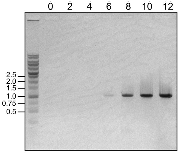 Detection of increasing viral RNA by 1-step reverse transcription PCR in a novel arenavirus, Zambia, 2009. Viral RNA was extracted from 100 μL of culture supernatant on the indicated days (top) and eluted in 20 μL of distilled water. The RNA sample was subjected to 1-step reverse transcription PCR with the specific primers 5′-TGAGAGACATTGCTTCACAATTGACATCC-3′ and 5′-TGACCCATTCTTGATGTATTGTGACTCC-3′, which were designed to amplify a 1,000-bp fragment within the determined large gene segment of Luna